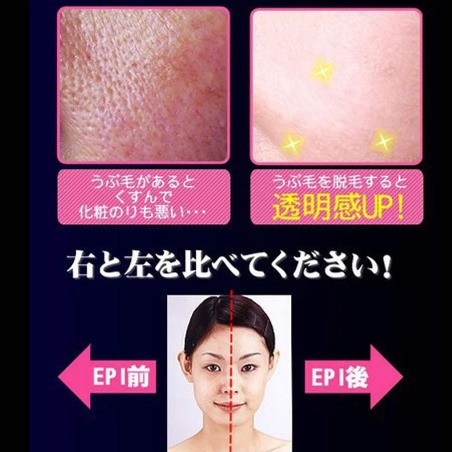 Устройство для удаления волос на лице/эпилятор изящной красоты лица микро