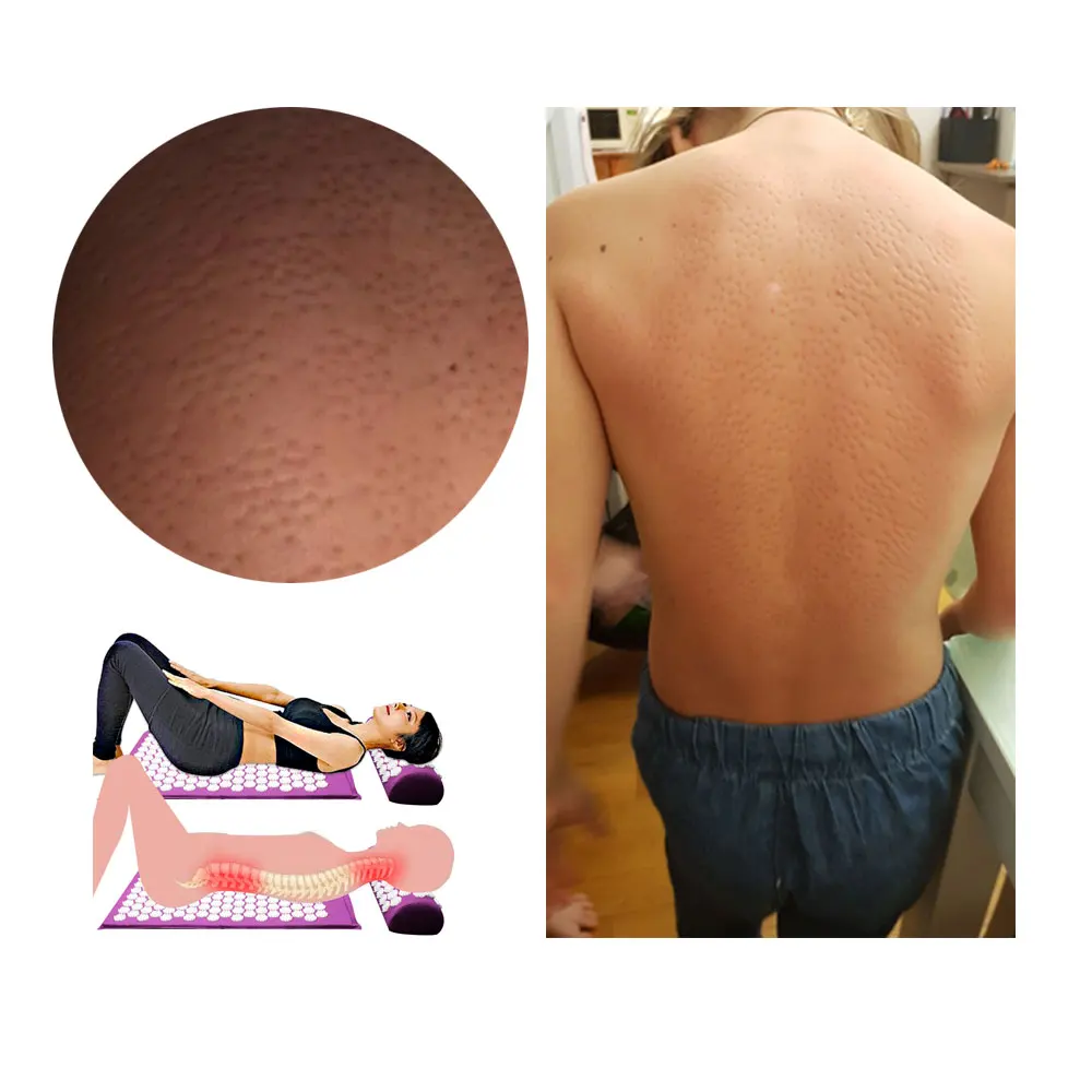 Массажная подушка для акупрессуры с розами размер M/L | Красота и здоровье