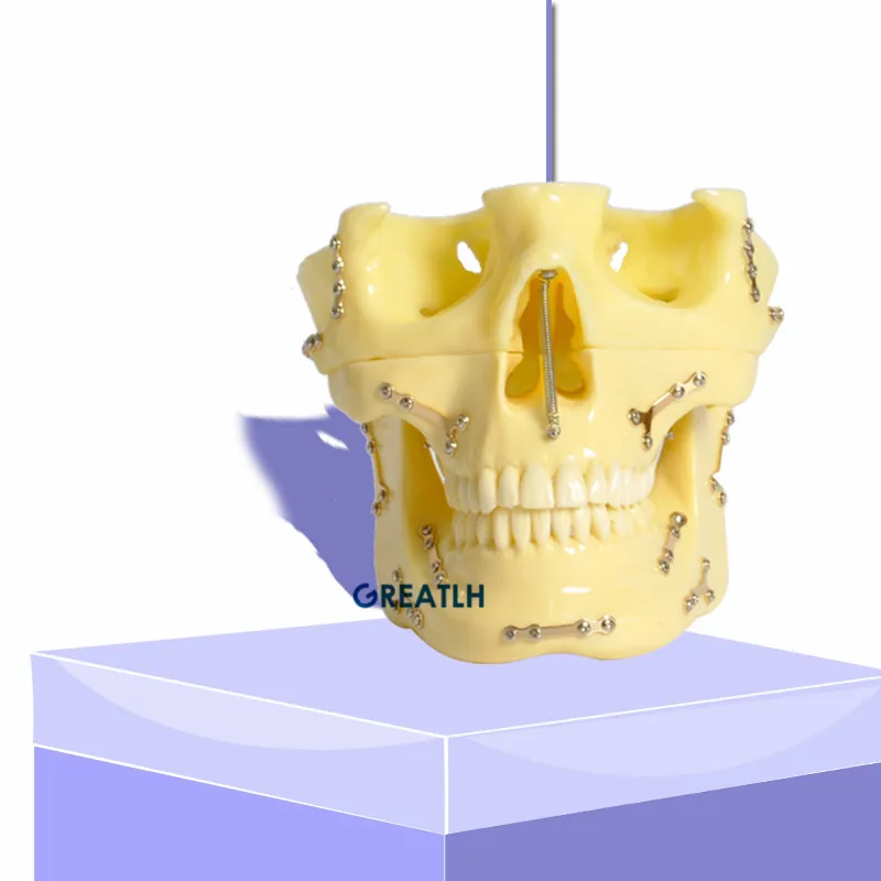 Dental Anchor Implant Screw model 2016  Teeth Practice Model Dental Teaching Model