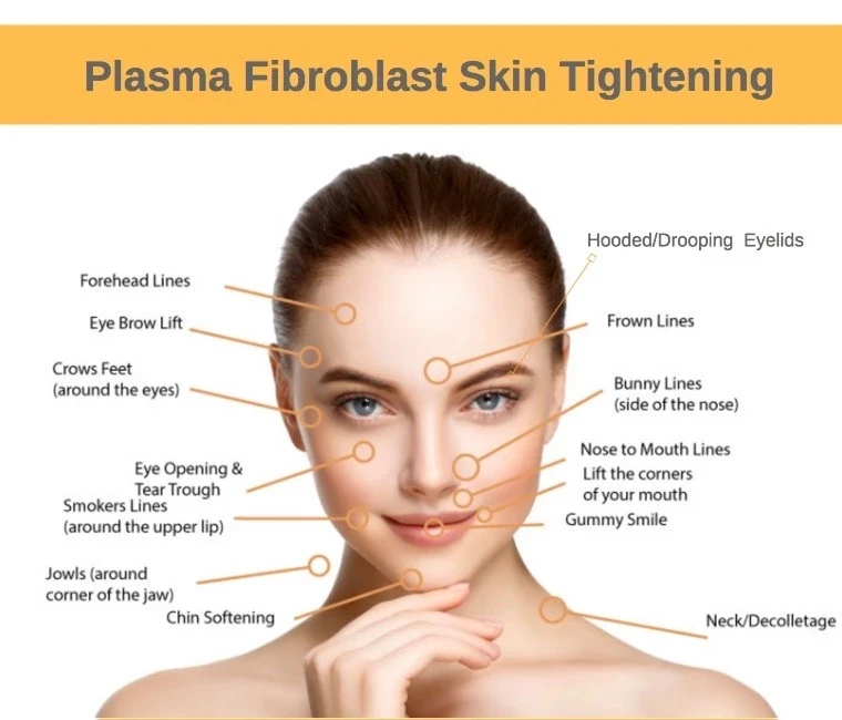 Домашнее использование мини jato de plasma caneta