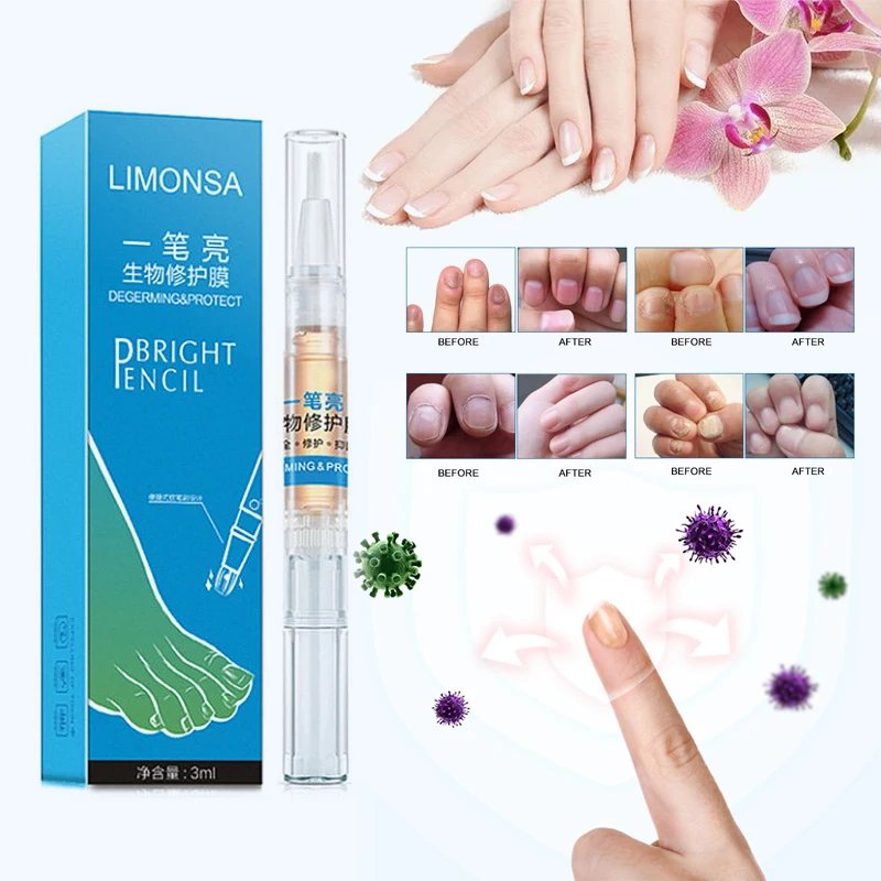 1 шт. ручка для лечения Ногтей онихомикоз паронихия противогрибковая инфекция
