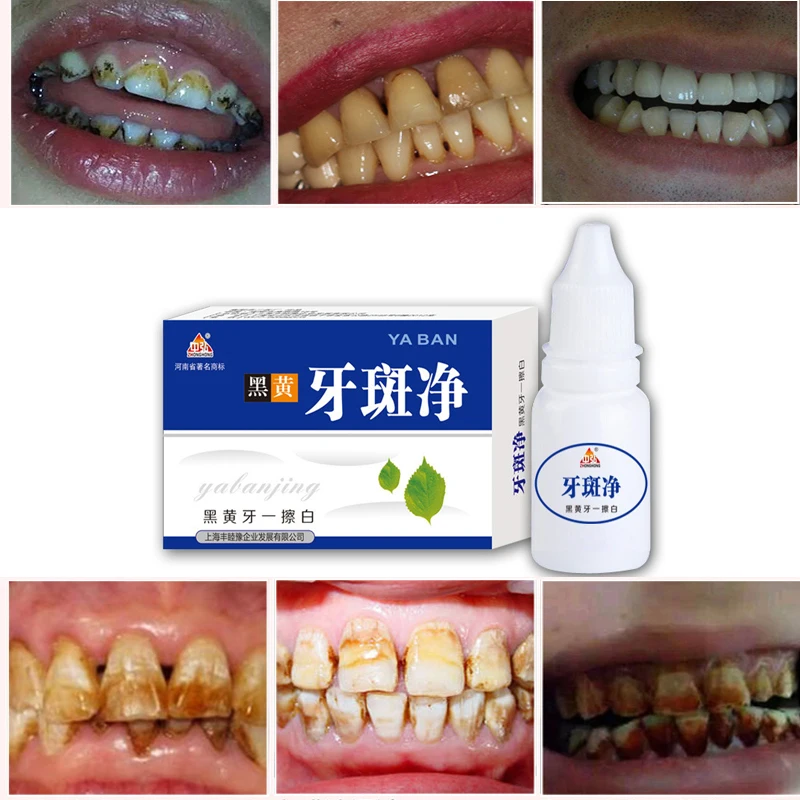 10 мл отбеливающая вода для зубов Гигиена полости рта уход за зубами Clareamento Dental