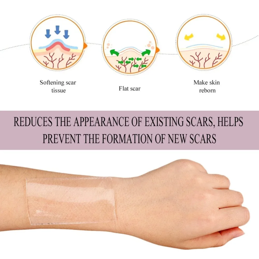 1 шт силикон для здравоохранения удаление патч многоразовый гель от угрей шрам