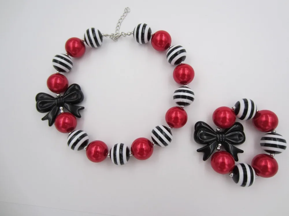 2 шт./компл. Детские милые подарки для девочек 20 мм в полоску массивные бусины