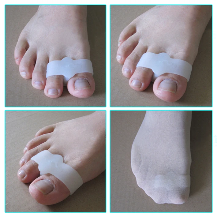 Новый силиконовый корректор пальца ноги фиксация фиксации большие черные