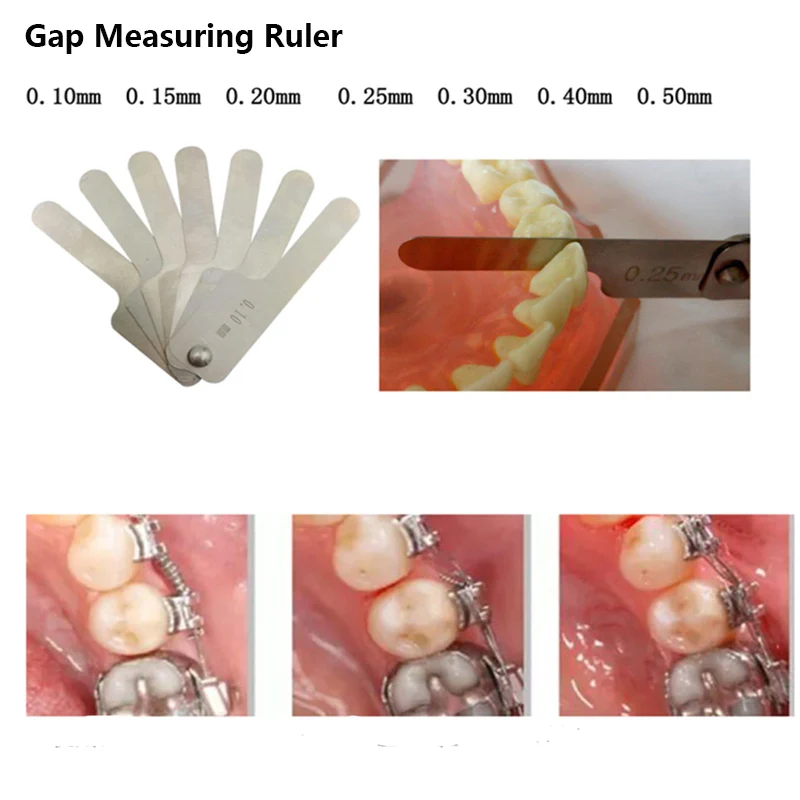 

Dental Interproximal Reduction Gauge Made of Stainless Steel Reciprocating IPR System Orthodontic Treatment Gap Measuring Rulerr