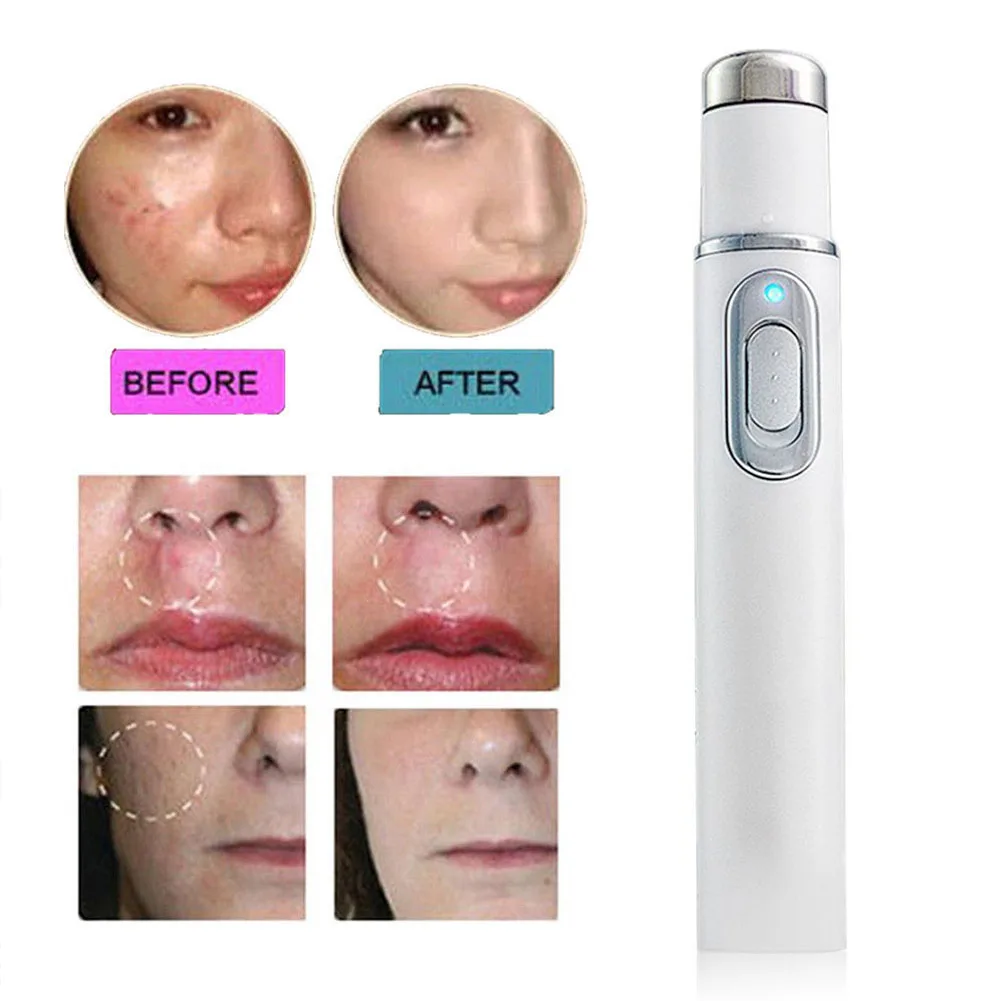 Soft Therapy Acne Laser Pen Blue Light Durable Face Skin Care Tools Massage Portable Scar Remover Machine KD-7910 |