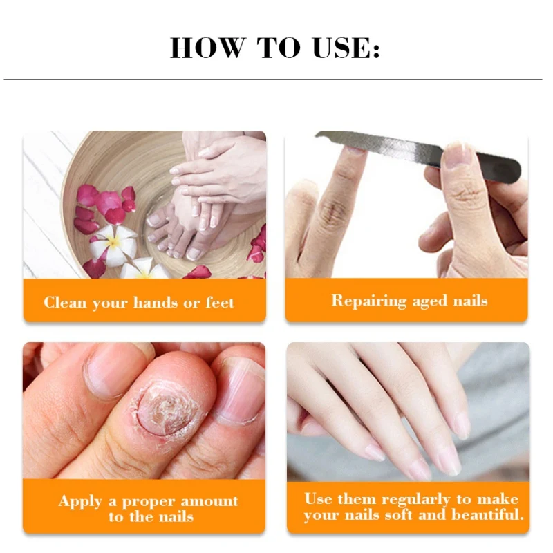 Nail Treatment Repair Gel Growth Product Remove Onychomycosis Broken Treatments | Красота и здоровье