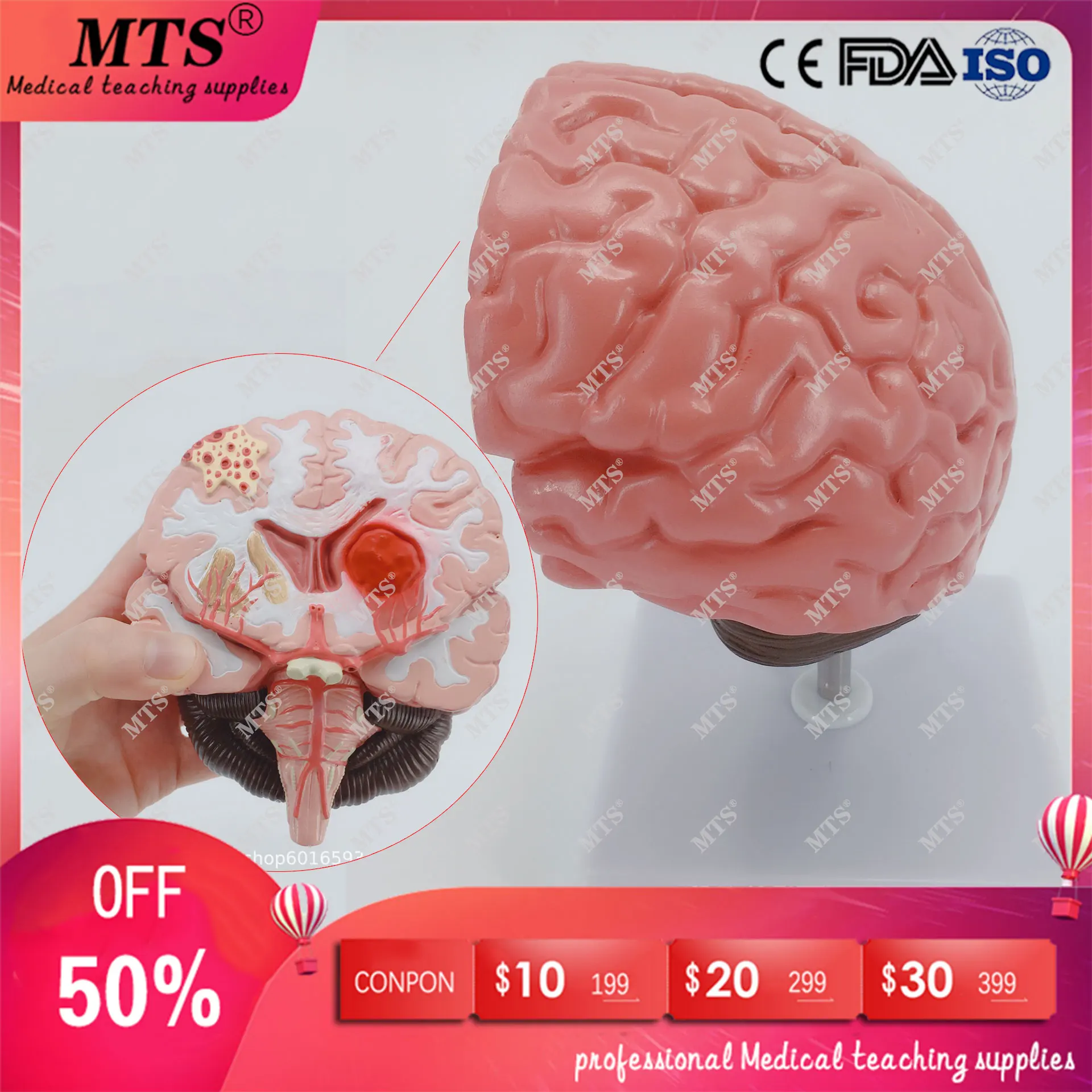 Конструкция головного мозга анатомическая модель движение патология нейрология