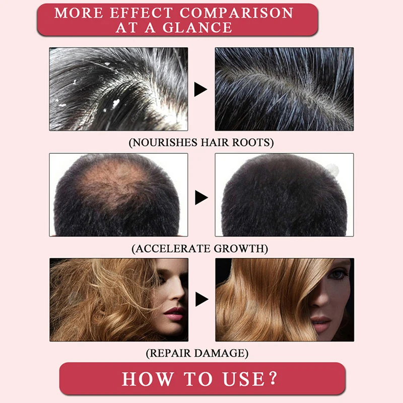 Имбирное масло для роста волос Andrea шампунь быстрого с имбирным маслом против