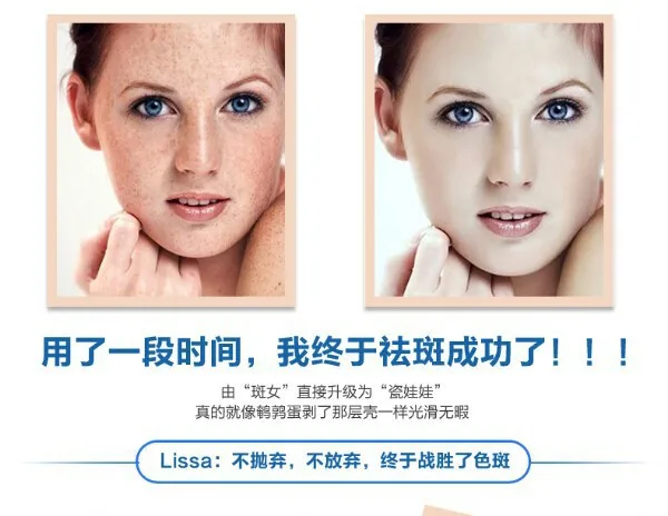 2N 28 days Medicated Pigment Skin Whitening Cream Chloasma Cyasma Melanin Removing freckle speckle Firm skin care face care