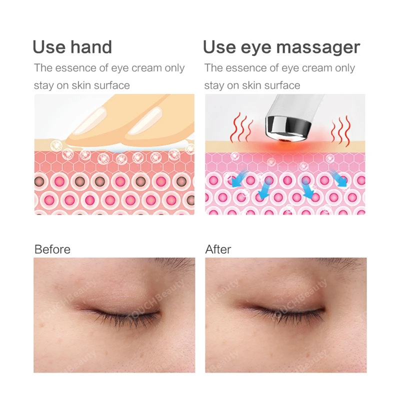 TOUCHBeauty анти-старения 40 Градусов Анти-патчи для ухода за областью вокруг глаз Массажер с высокой частоты вибрации и красный светильник для устранения морщин TOUCHBeauty TB-1662