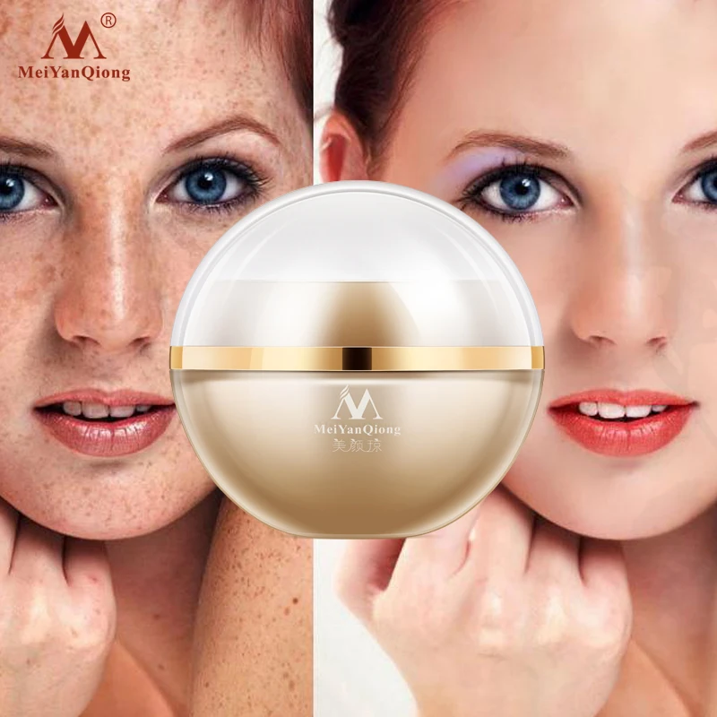 Proessional Веснушка крем уход за кожей отбеливание увлажняющий меланин для удаления