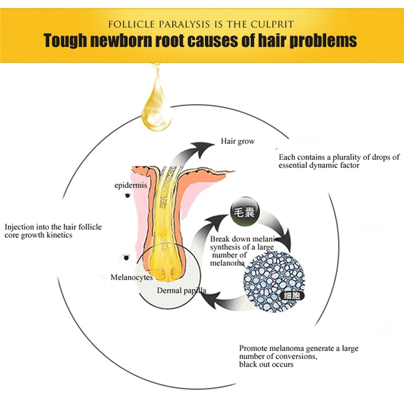 30 мл здоровые волосы глубокая забота быстрое восстановление роста волос Regrowth