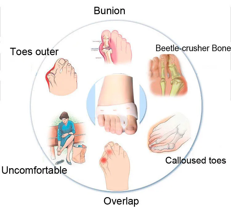 1 пара = 2 фото оригинальные новые специальные вальгусные велосипедные