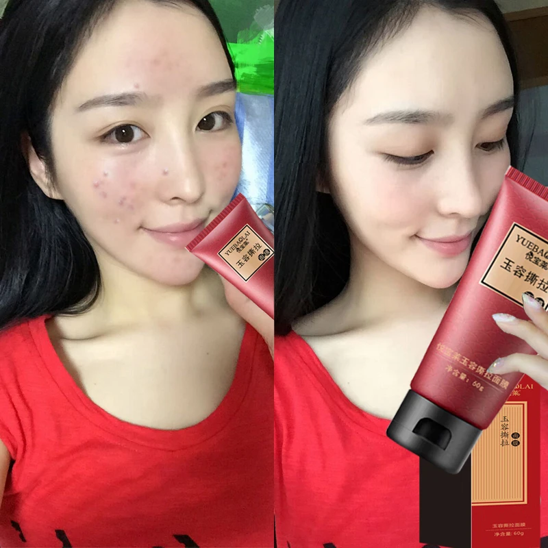 Уход за Кожей маска для ухода лицом удаление черных точек носа контроль жирности