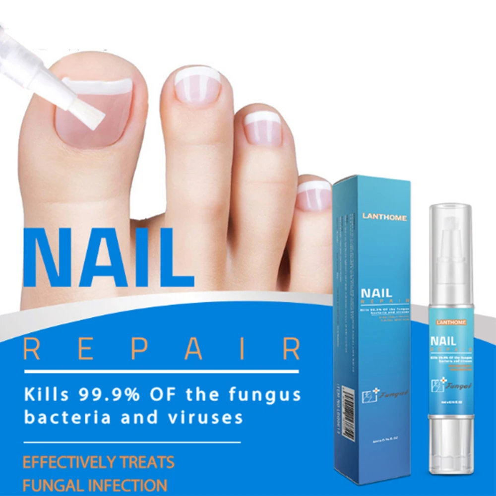 4 мл китайская Ручка для лечения Ногтей онихомикоз пароникья против грибковой