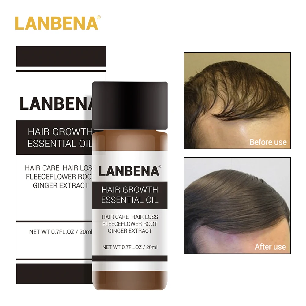 10 шт. эфирное масло для выпадения волос LANBENA мужчин и женщин набор ремонта