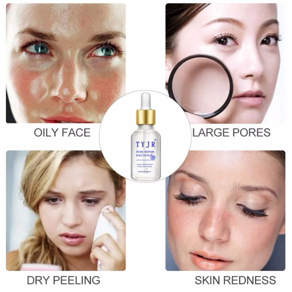 Snail Essential Liquid Moisturizing Firming Skin Lighten Fine Lines Anti-Drying Anti-Aging Face Serum | Красота и здоровье