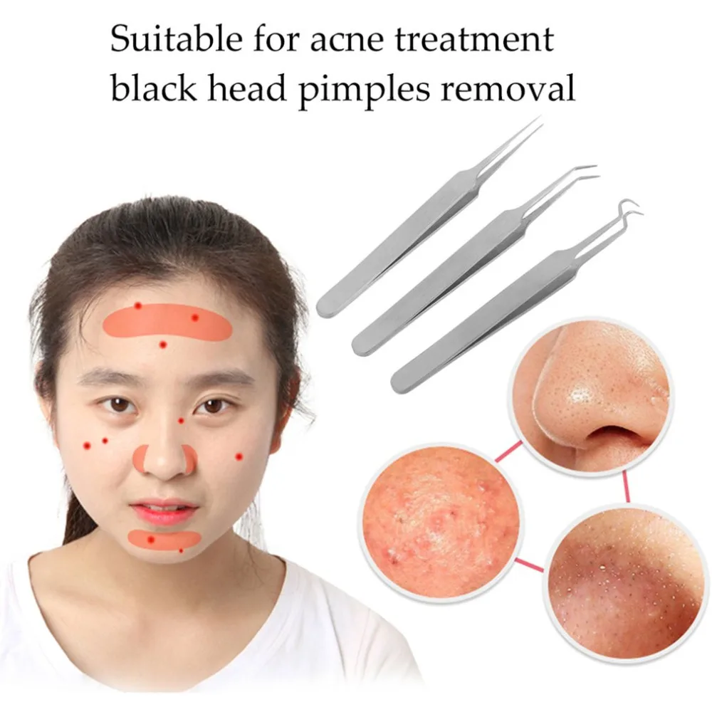 1 шт. игольчатый Пинцет для прыщей угрей прыщи удаление заостренный изгиб Gib