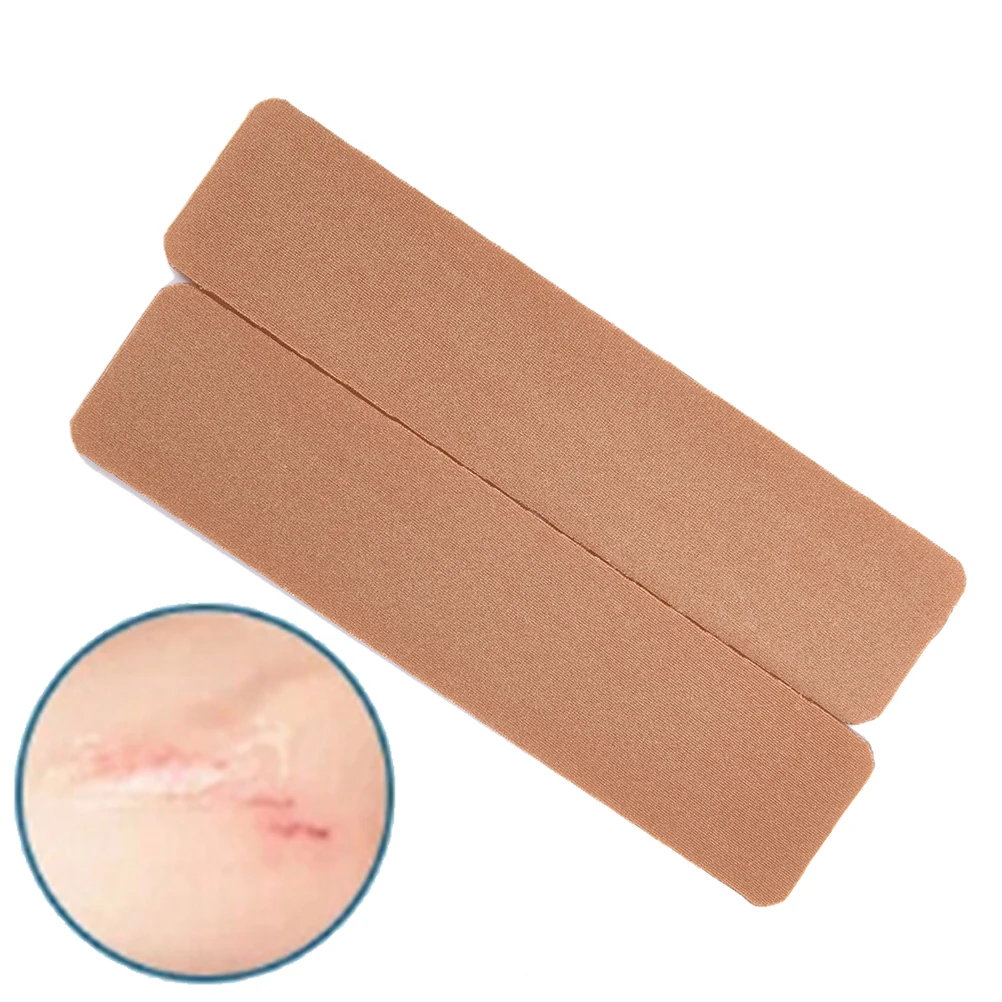 

2pcs Scar Away Patch Silicone Gel Sheet Wound Marks Removal Cesarean Keloid Skin Scars Therapy Treatment 15cm x 3.5cm x 2mm