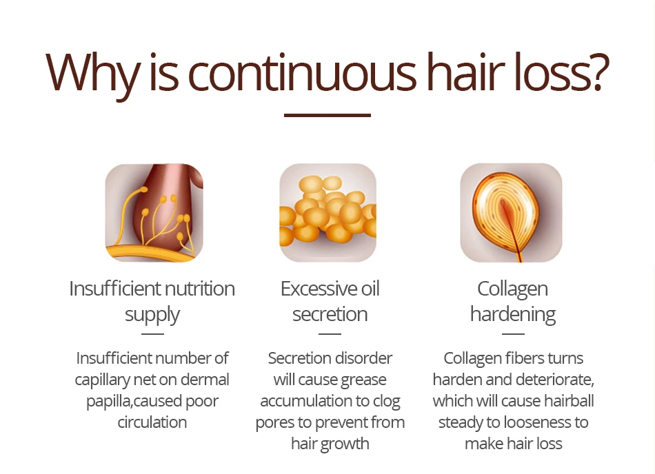 30ml Hair Growth Serum Essence Spray for Women and Men Anti Prevent Hair Loss alopecia Liquid Damaged Hair Growth Liquid
