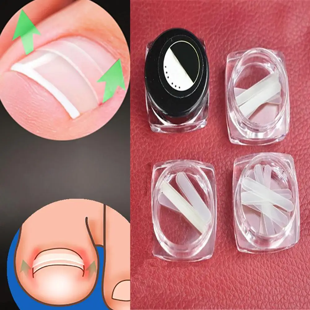 

10Pcs/Box Foot Care Tool Ingrown Toe Nail Correction Sticker Paronychia Foot Care Treatment Pedicure New