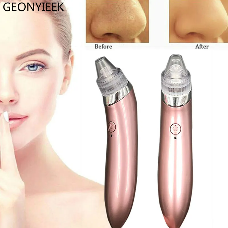 Электрический инструмент для удаления акне Noir Blackhead пылесос с черными пятнами