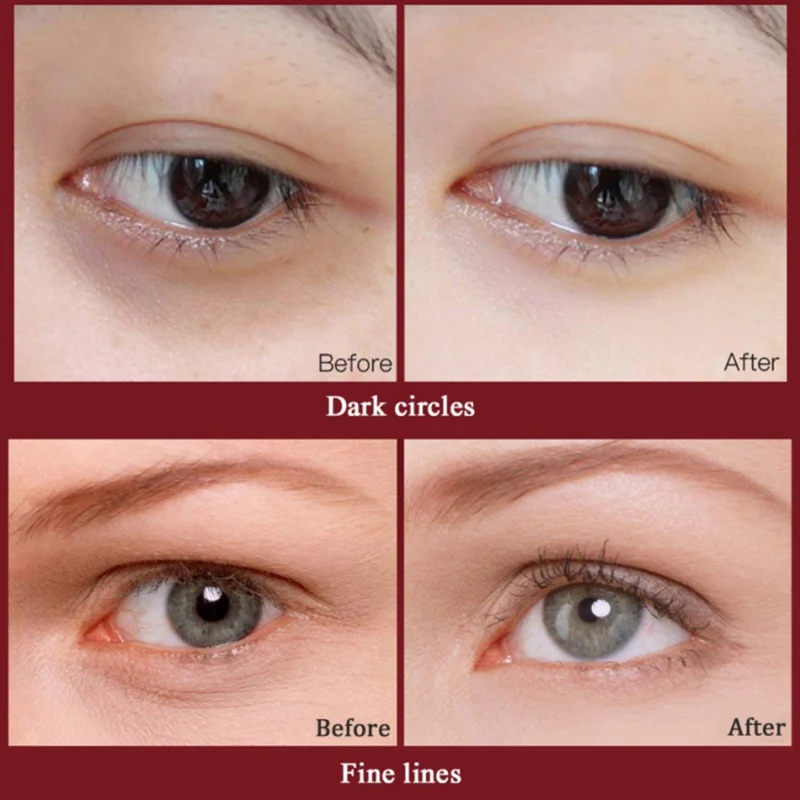 Влажный эластичный уход за кожей лица удаление отечности и темных кругов против