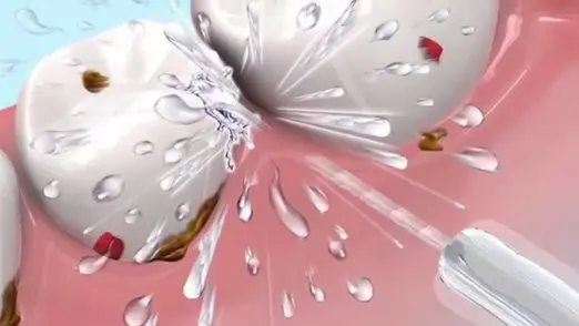 Зубная нить ирригатор для полости рта стоматологический спа-очиститель зубная