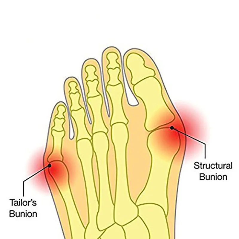 2 Флейта для большого пальца | Красота и здоровье