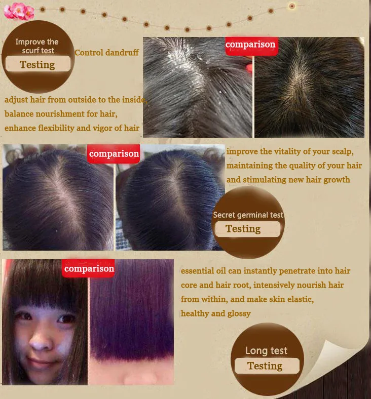 Уход за волосами масло для волос быстрый рост Essence плотные против выпадения