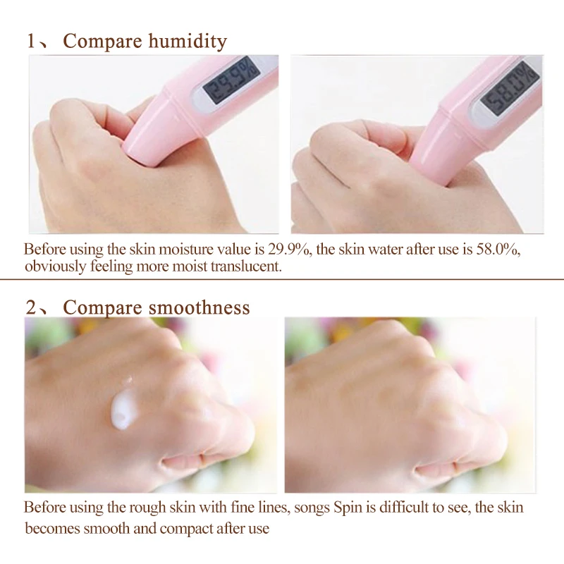 Baimiss улитка сыворотки ремонт лосьон для лица крем лечение акне угорь уход за