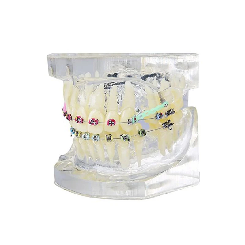 1 шт. прозрачная модель зубов Ортодонтическая цветная для обучения