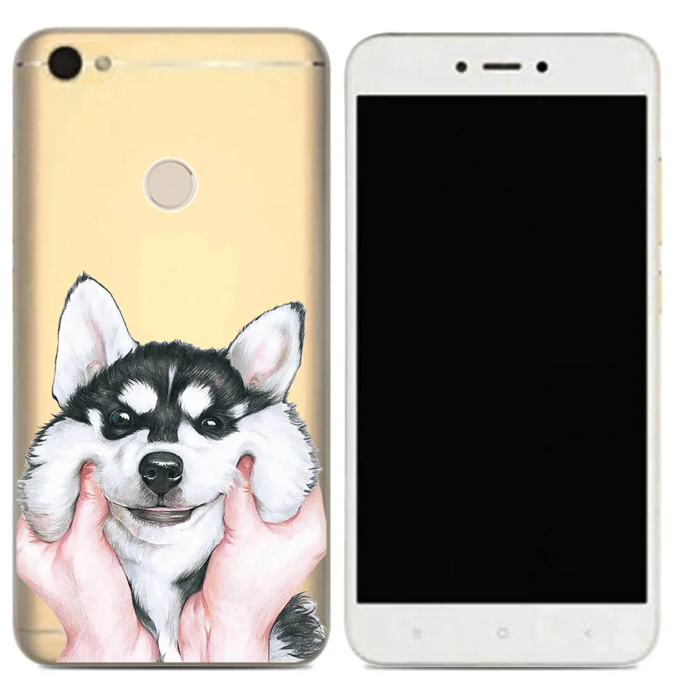 For Xiaomi Redmi note 5A pro TPU Ultra thin Phone Case Silicone Cover Clear for note5A phone back cover |