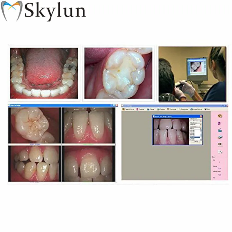 Dental Intraoral Camera USB Oral 1/4 Sony CCD 2.0 Mega Pixels Automatic Focusing Dentist Imaging System Tool SL960 | Красота и