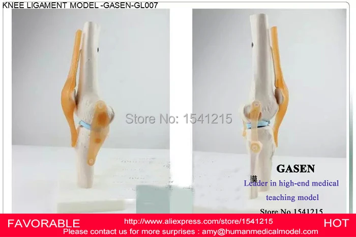 Анатомическая медицинская функциональная модель Связки коленного сустава для