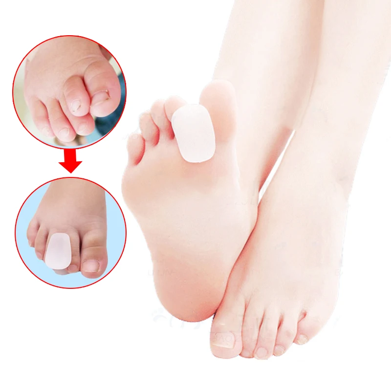 2 пары гелевых инструментов для ухода за ногами корректор бурсита разделитель