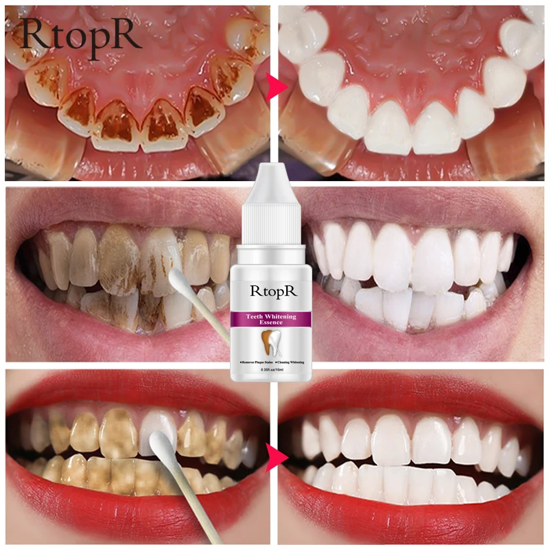 Белые зубные зубы Dientes Clareamento Blancos Limpieza Clarear Os Dentes Sarro Withing отбеливание Branqueador