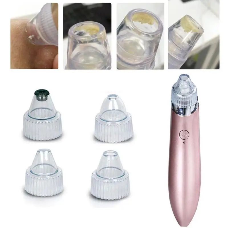 Средство для удаления акне точка Noir Blackhead вакуумный экстрактор инструмент черные