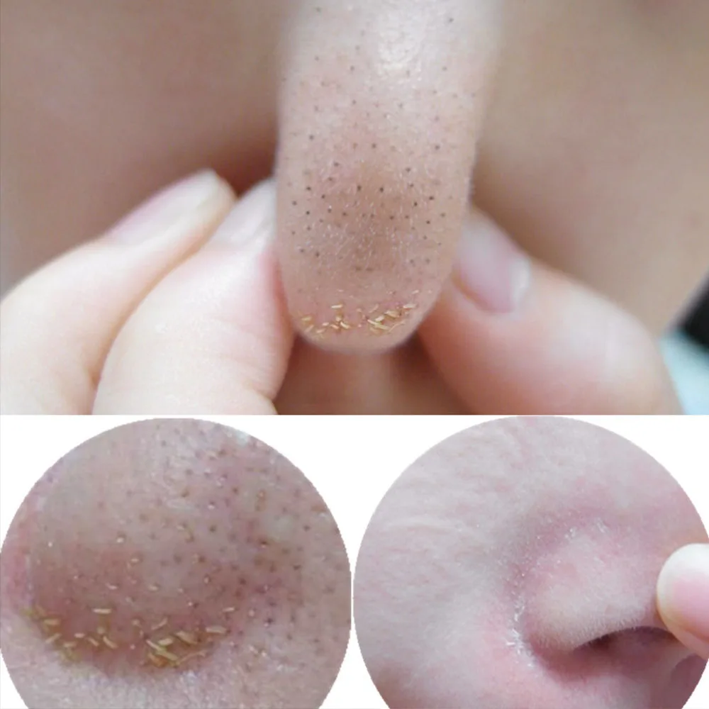 

1Pc Bamboo charcoal Mud Blackhead Cleaner Sheet Black Spot Remover Deep Cleansing Pore Contraction Purifying Mask Skin whitening