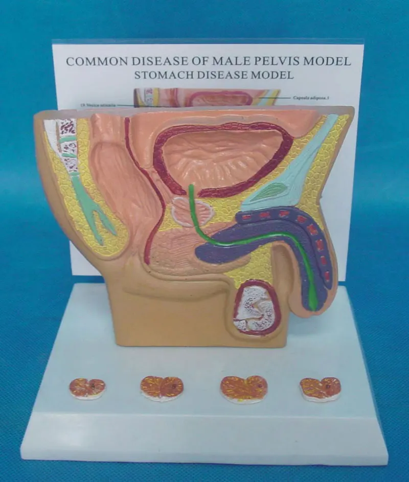 

Men intraperitoneal bladder Prostate Health and Pathological model Genital Anatomy free shipping
