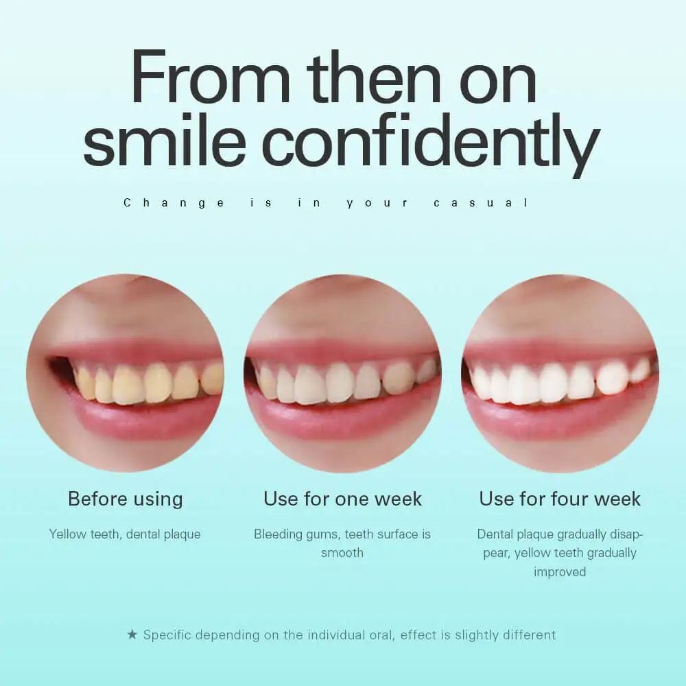 Сменные насадки для зубной щетки AZDENT 5 шт./лот профессиональная звуковая