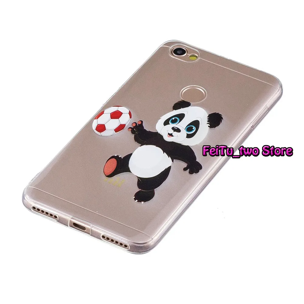 Transparent TPU Case For Xiaomi Redmi Note 5A Prime Y1 MDG6S Shell Red mi Note5A Soft Silicone Phone Cover Bag |