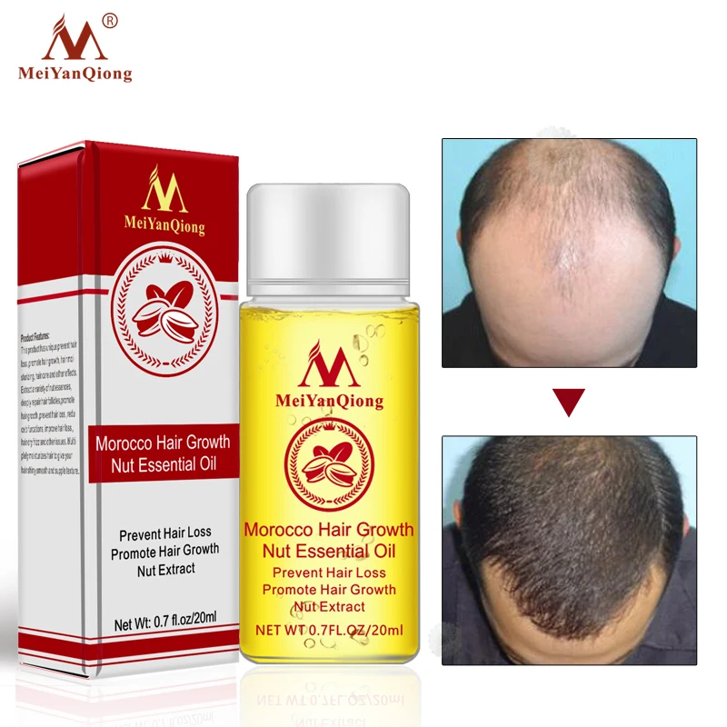 New Arrival Andrea Hair Growth Products Ginger Oil Faster Grow Shampoo Stop Loss Treatment | Красота и здоровье