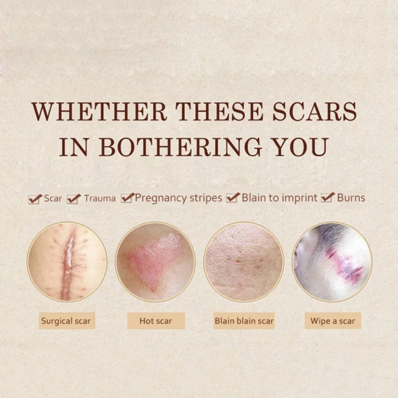 20 мл сглаживание кожи ремонт жидкости травма хирургия шрам тиснение шрамов уход