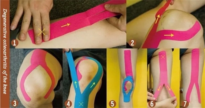 Кинезио тейпами(Kinesio tape) улучшает кровообращения и лимфотока 2074