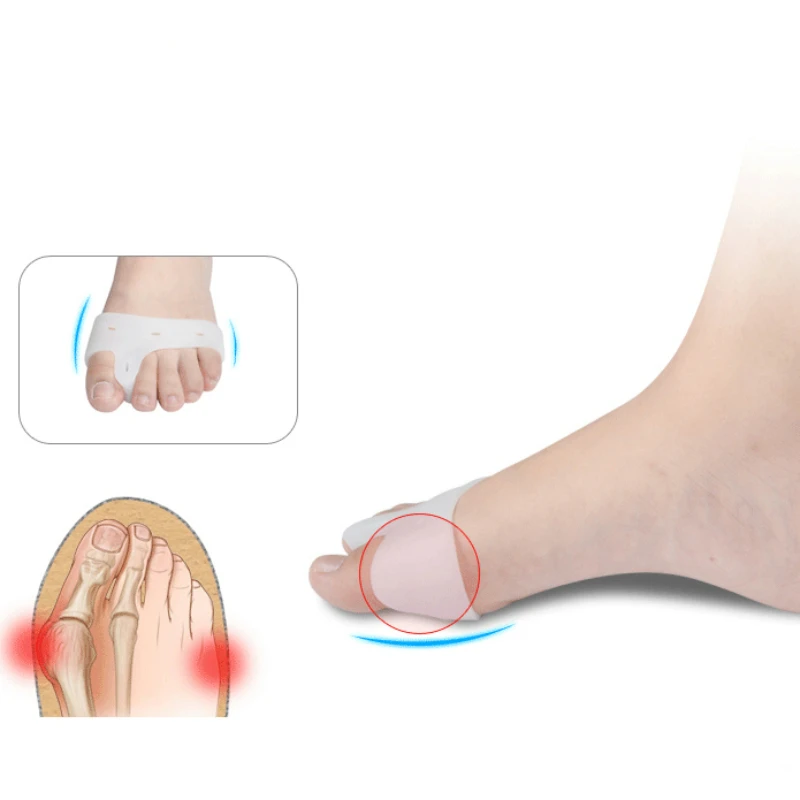 1Pair Silicon Gel Foot corrector Toe separator Thumb valgus protector Bunion adjuster Hallux Valgus Guard Feet care | Красота и