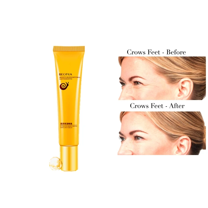 

Treatment Red Eye Cream Face Care Anti Wrinkle Remove Dark Circles Moisturizing Hydrating Whitening Firming Eye Cream 20g/Pcs