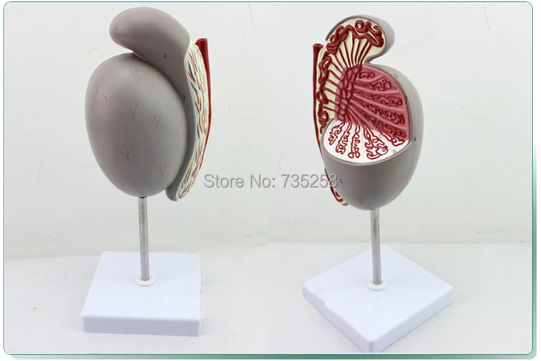 Human Testicular Enlargement Model,Genital Tube Model,Testicular Anatomical Structure Model